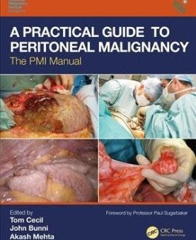 A Practical Guide to Peritoneal Malignancy Sale