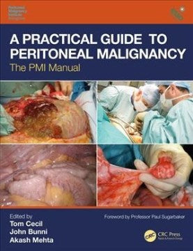 A Practical Guide to Peritoneal Malignancy Sale