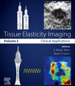 Tissue Elasticity Imaging Online Sale