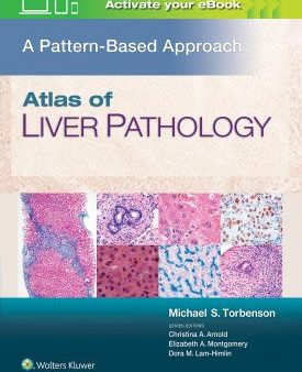 Atlas of Liver Pathology For Cheap